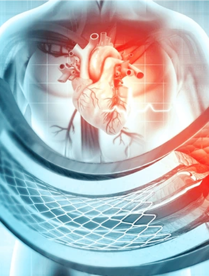 coronary angiogrpahy